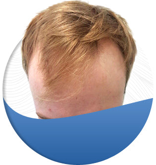 Pacific Hair Solutions Waikiki